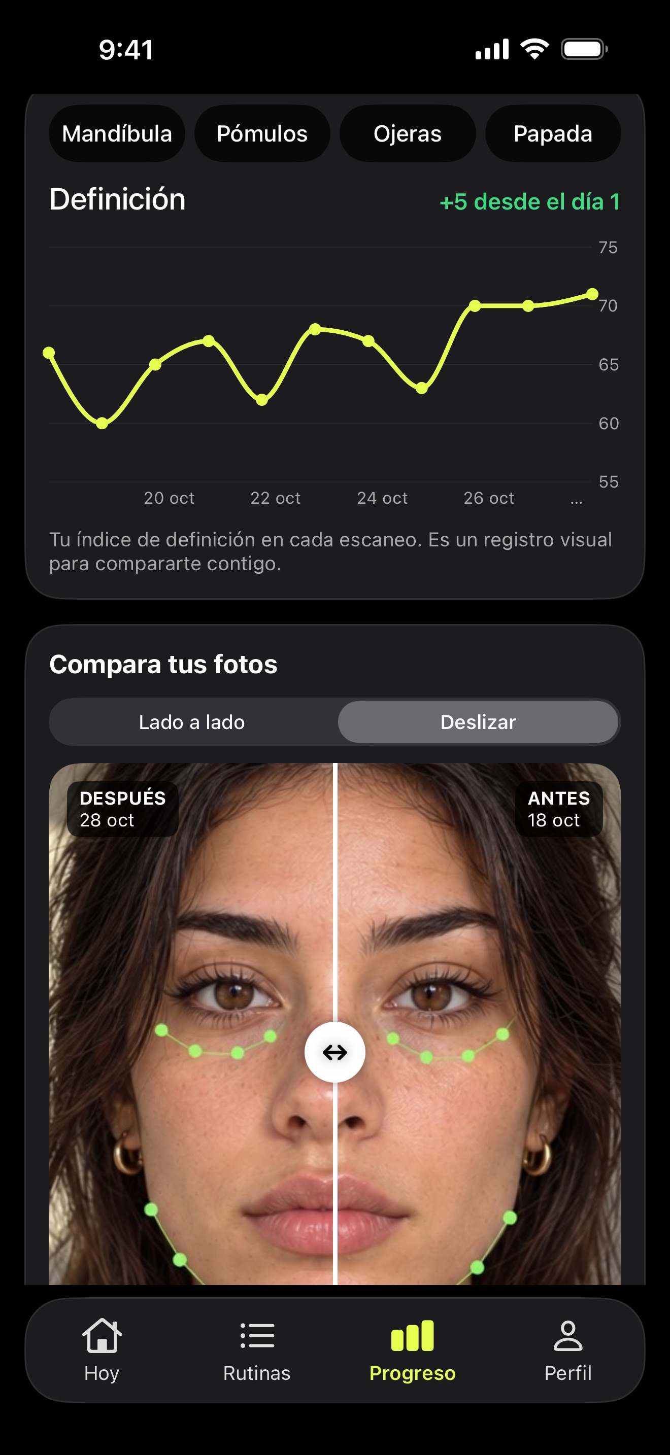 Pantalla Progreso: gráfica del índice de definición de 10 días y comparación de fotos antes y después.