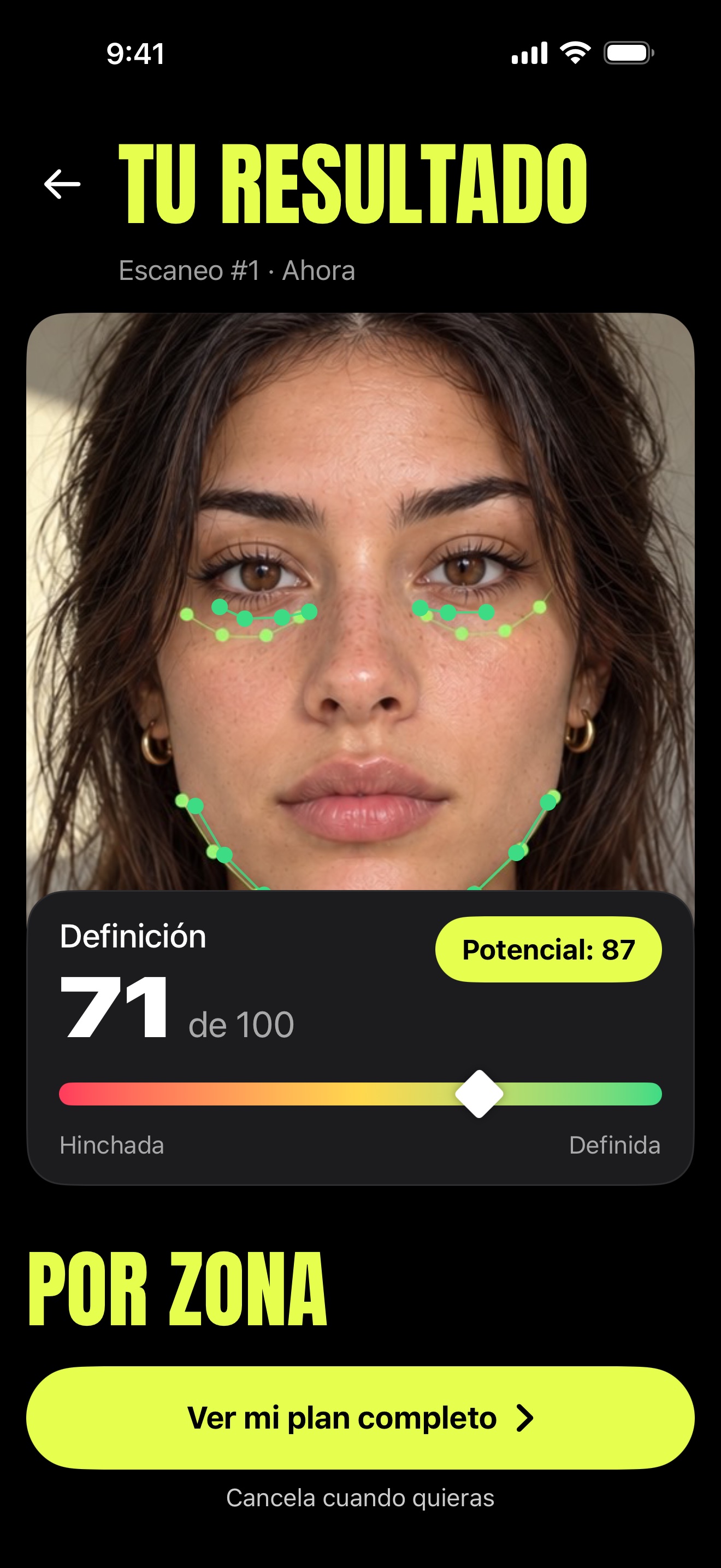 Pantalla Tu resultado: definición 71 de 100, potencial 87, con puntos de referencia en ojeras y mandíbula.